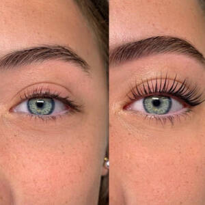 Lash Botox before and after
