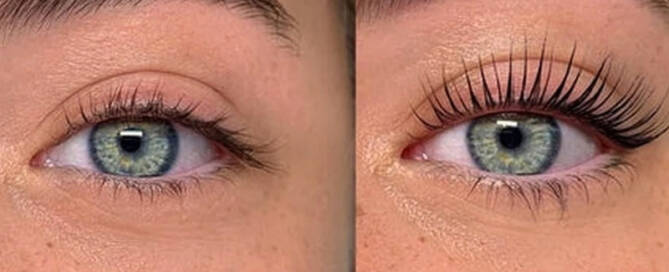 Lash Botox before and after