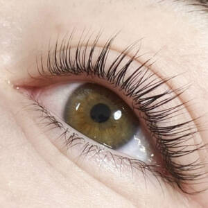 What is Eyelashes Botox