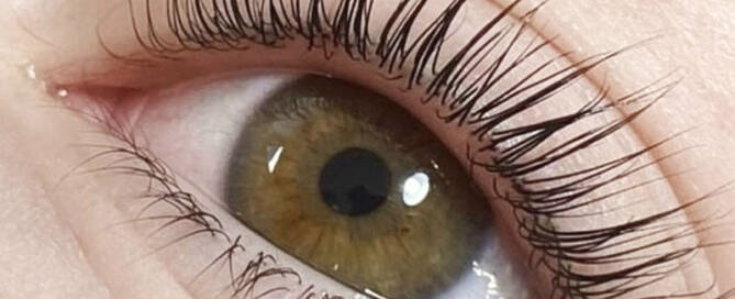 What is Eyelashes Botox